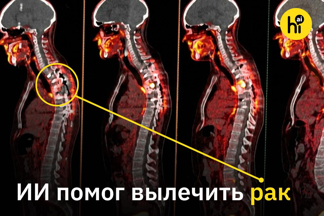 Иллюстрация к статье